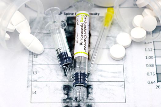 testosterone estradiol SHBG how to interpret hormone panel - FAQ: testosterone, estradiol, and SHBG interpretation