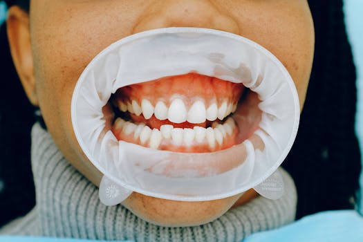 oral microbiome and systemic inflammation - Common misconceptions that can keep inflammation going