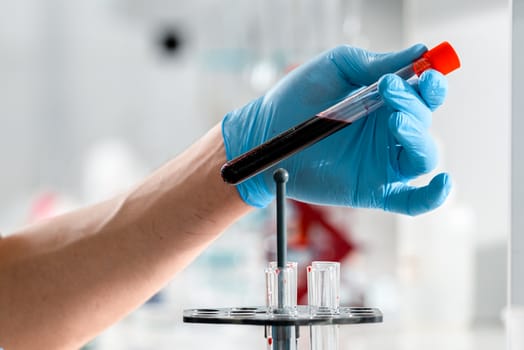home blood test vs lab draw accuracy turnaround - Two ways to get blood results: home testing kits vs clinician lab draws
