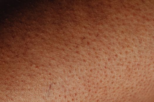 uneven pigmentation troubleshooting dark spots causes - Specific troubleshooting by common cause
