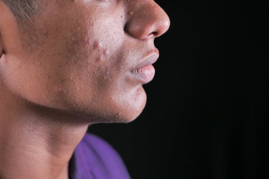 dandruff vs seborrheic dermatitis vs contact dermatitis - How symptoms typically differ on the scalp
