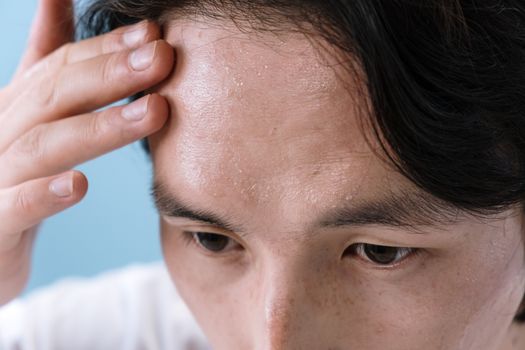 dandruff vs seborrheic dermatitis vs contact dermatitis - When to consider dermatology evaluation