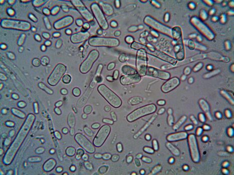 semen analysis interpretation motility morphology volume - When to seek fertility care sooner rather than later